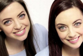 Kỳ lạ những “bản sao” không cùng huyết thống giống “chính chủ” như đúc