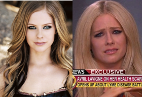 Avril Lavigne suy sụp vì bệnh hiếm gặp