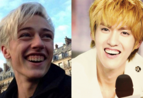 Những ngôi sao thế giới khiến fan vỡ mộng vì nụ cười hở lợi