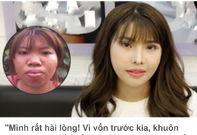 ‘Chọn mặt gửi vàng’ khi thẩm mỹ vùng mặt