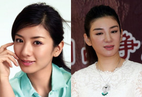 Loạt sao Hoa Ngữ vất vả lấy lại nhan sắc sau thẩm mỹ thất bại