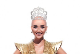 H’Hen Niê sẵn sàng cạo đầu để giành chiến thắng ‘Cuộc đua kỳ thú’