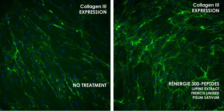 Collagen III 1 bước trước thời gian với kem dưỡng 300 Peptide Rénergie từ Lancôme