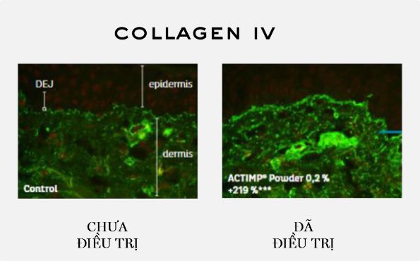 Collagen IV 1 bước trước thời gian với kem dưỡng 300 Peptide Rénergie từ Lancôme