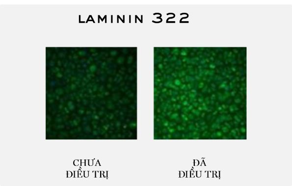 Laminin 322 1 bước trước thời gian với kem dưỡng 300 Peptide Rénergie từ Lancôme
