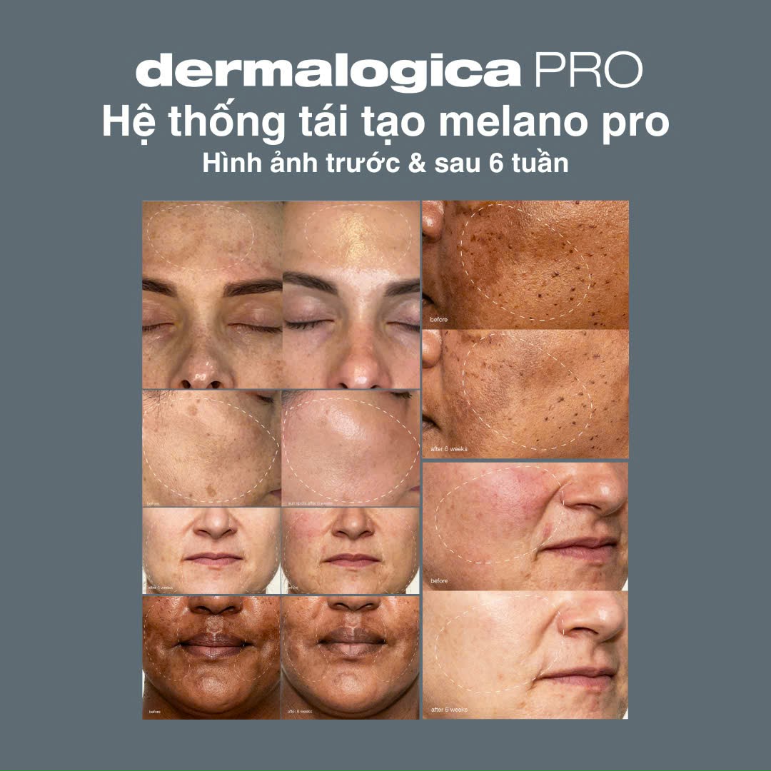 derma Dermalogica ra mắt giải pháp toàn diện khắc phục vấn đề sắc tố da